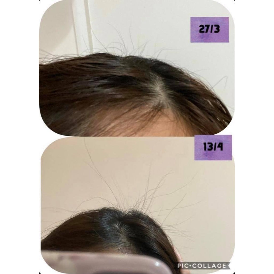 Revitalizing Scalp Essence (5.29oz)